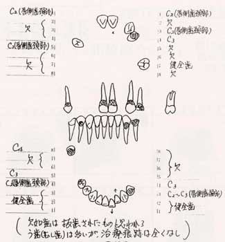 着衣